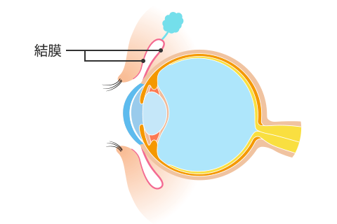 結膜の位置説明の画像