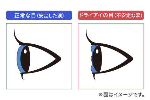 ドライアイの目と、通常の状態の目のイメージ