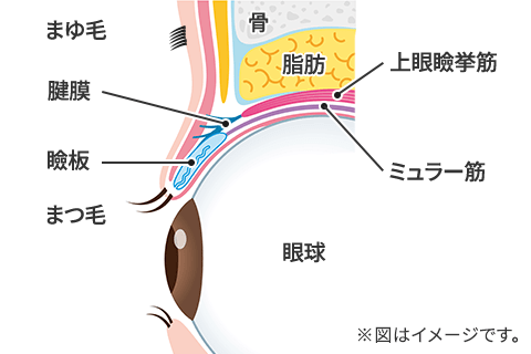 眼瞼下垂の状態イメージ