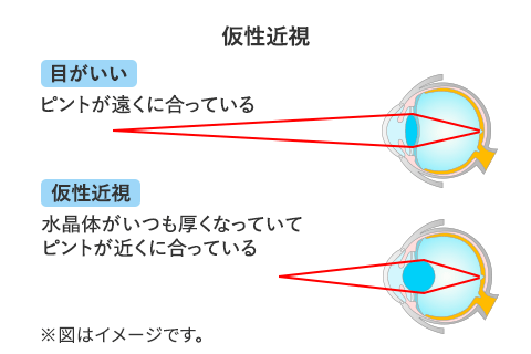 仮性近視の見え方イメージ