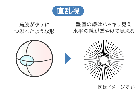 直乱視の角膜と見え方のイメージ図