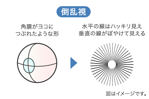 倒乱視の角膜と見え方のイメージ図