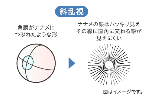 斜乱視の角膜と見え方のイメージ図