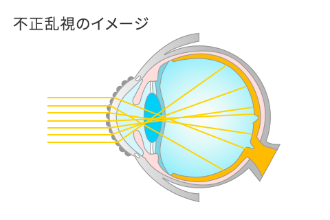 不正乱視のイメージ