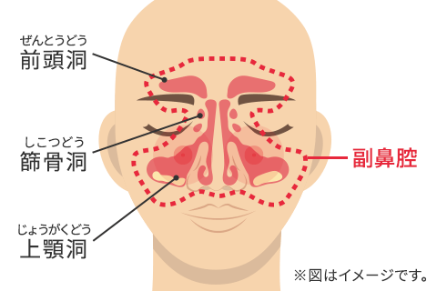 副鼻腔炎のイメージ