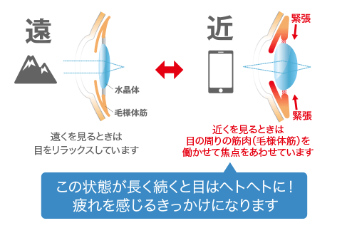 毛様体筋の緊張のイメージ図